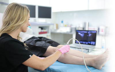 8 Common Vein Treatment Questions and Answers
