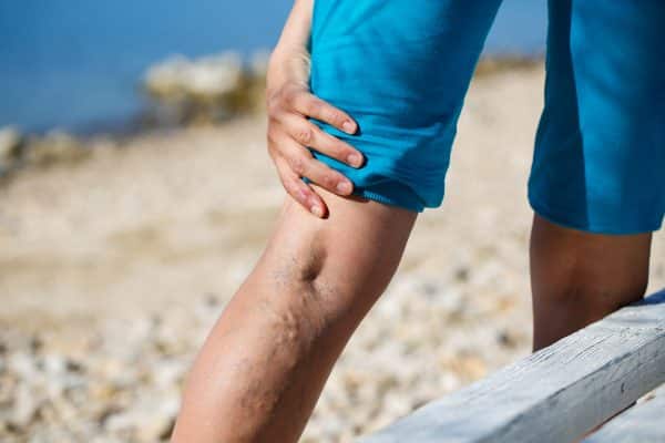 Minimally invasive treatments for varicose veins are simple and non-invasive. A vein clinic near Hackensack describes the entire minimally invasive vein treatment process.