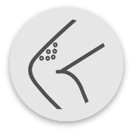 RF Ablation Sclerotherapy vein treatment in San Diego, California. Performed by Harvard Trained Vein Doctors