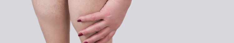 Spider legs reaching down woman in 30s shutterstock_1127173766