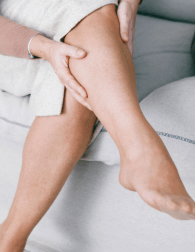 varicose vein treatment