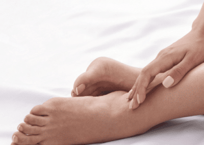spider vein treatment near me