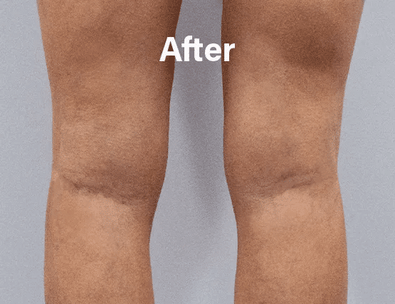 vipcenters_contents_before-after1.webp