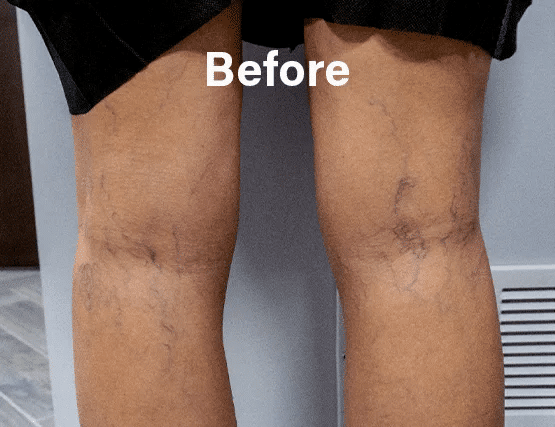 vipcenters_contents_before-after2.webp