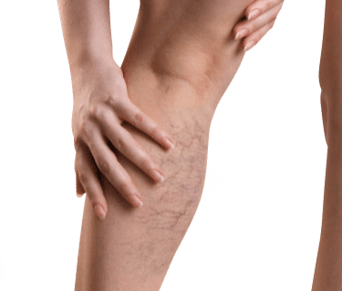 vipcenters_njlocations_bestclinic_leg-min