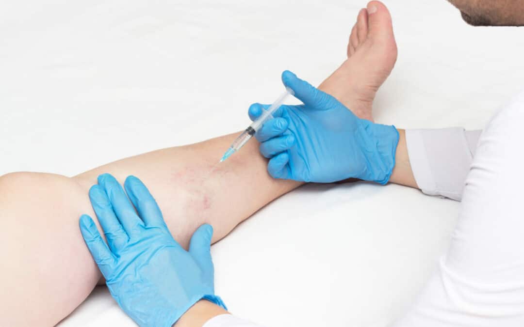 What is a vein mapping test? How long does a vein mapping take? Here are answers to 10 frequently asked questions about vein mapping in New Jersey.