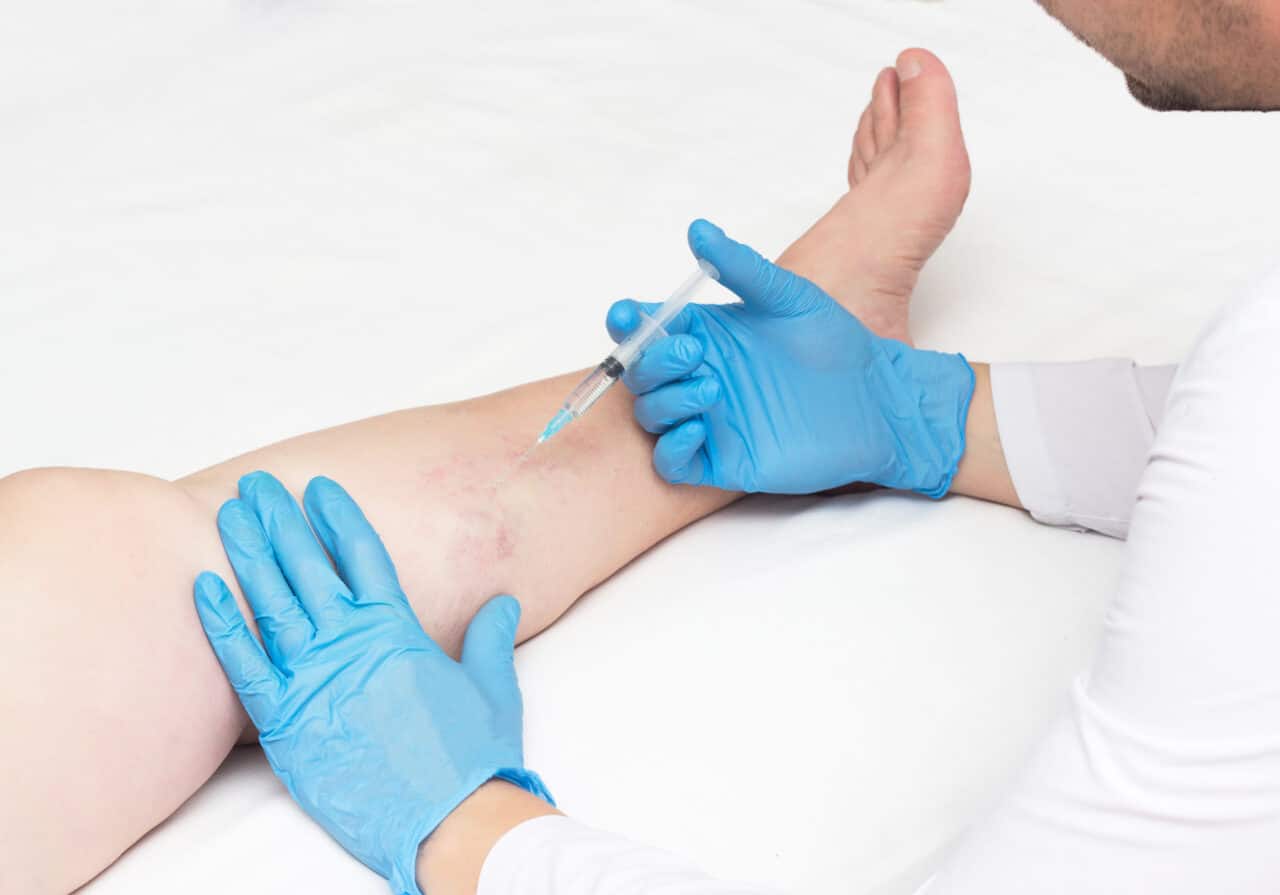 Are you looking for the best vein doctor in New Jersey? The spider vein and varicose vein clinic is led by the best vein doctors in New Jersey.